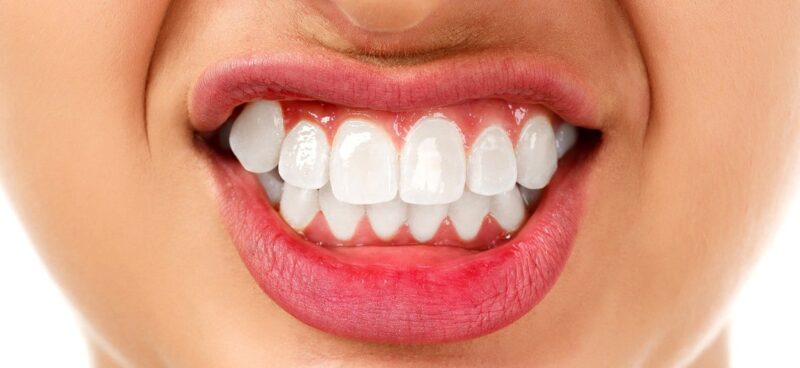 Blog -Hazelwood Dental