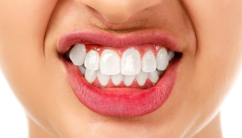Blog inner thumb : Hazelwood Dental