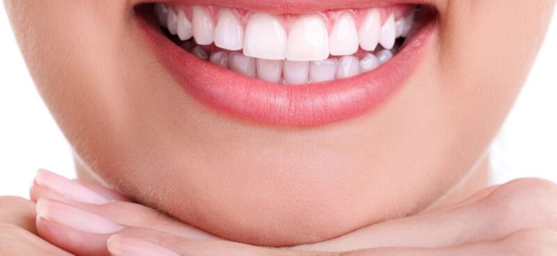 Blog -Hazelwood Dental