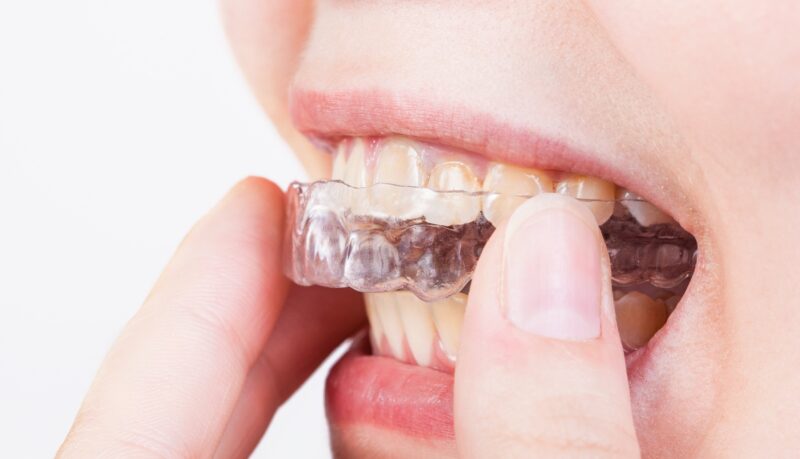 Blog inner thumb : Hazelwood Dental
