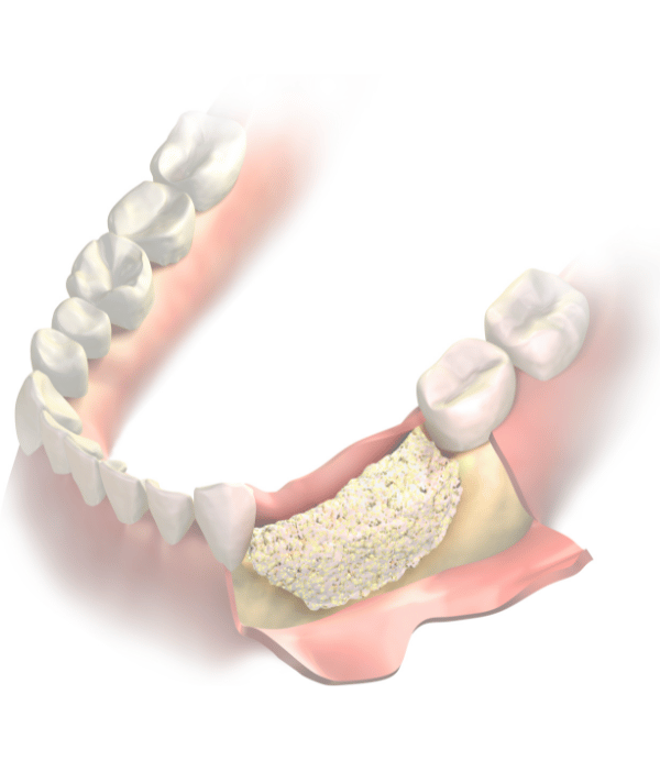 Treatment - Hazelwood Dental