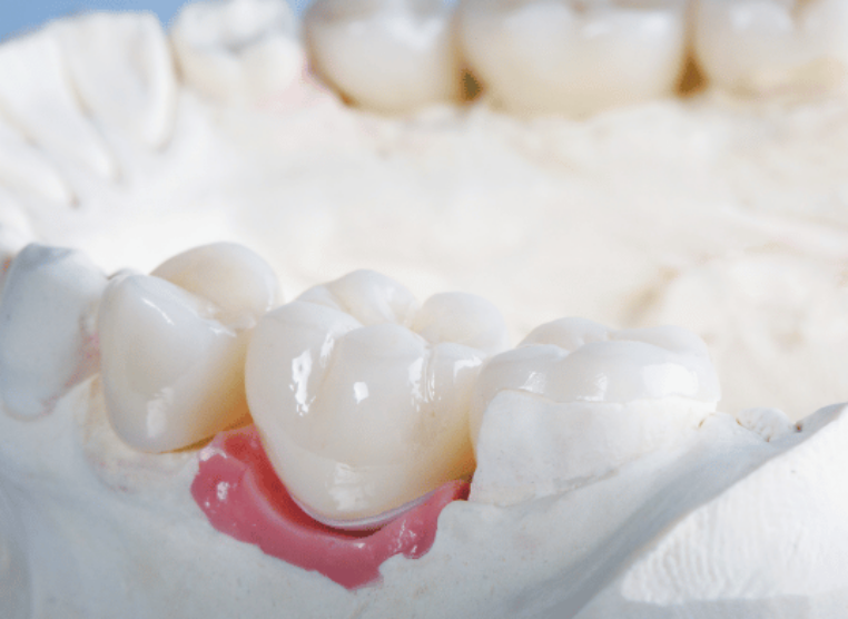 Hazelwood Dental Treatment Journey Image